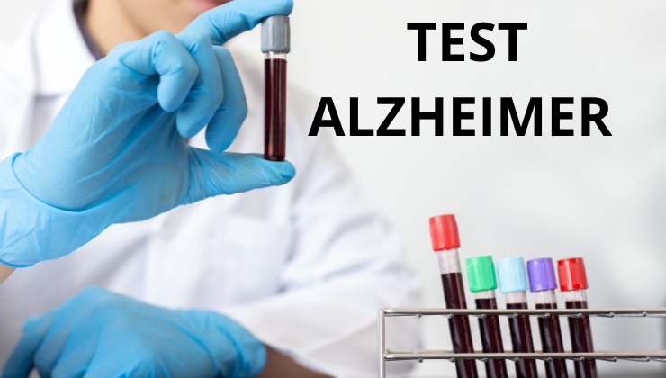 Scoperto test per diagnosi precoce Alzheimer