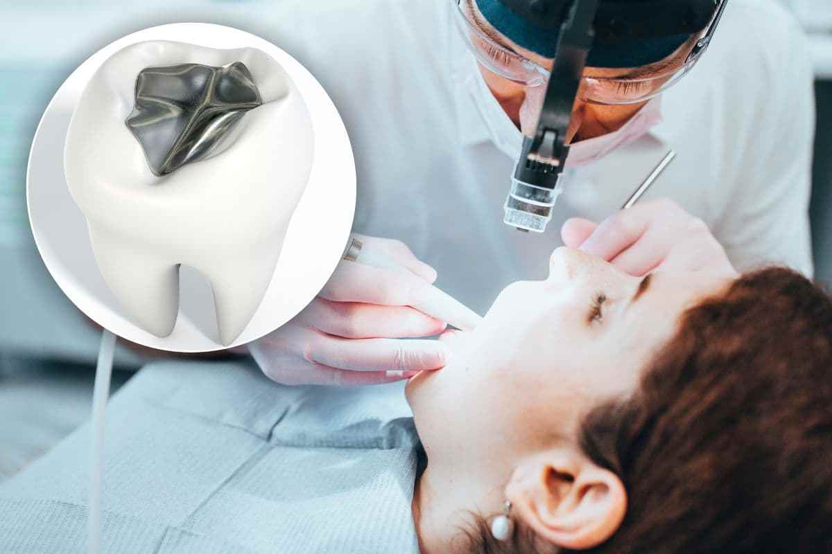 correre dal dentista per otturazione